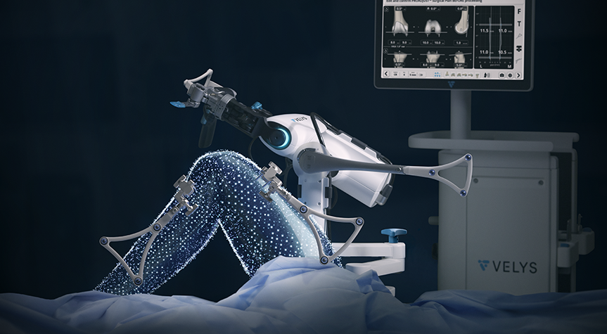 VELYS™ Robotic-Assisted Solution