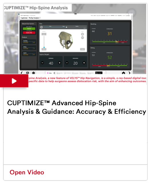 CUPTIMIZE™ Advanced Hip-Spine Analysis & Guidance: Accuracy & Efficiency