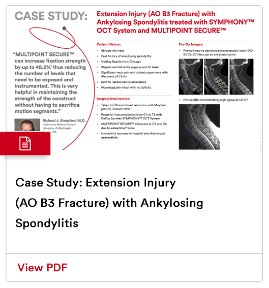 Extension Injury Case Study Image