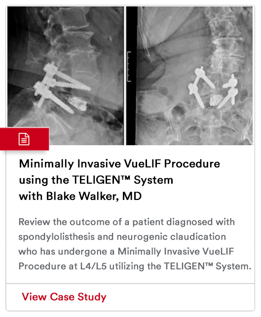 Case Study Image