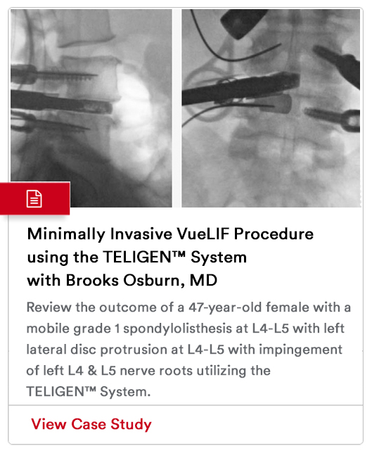 Case Study Image