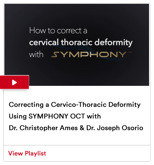 Image from Correcting a Cervico-Thoracic Deformity