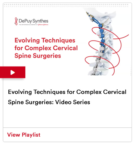 Image from Evolving Techniques for Complex Cervical Spine Surgeries: Video Series