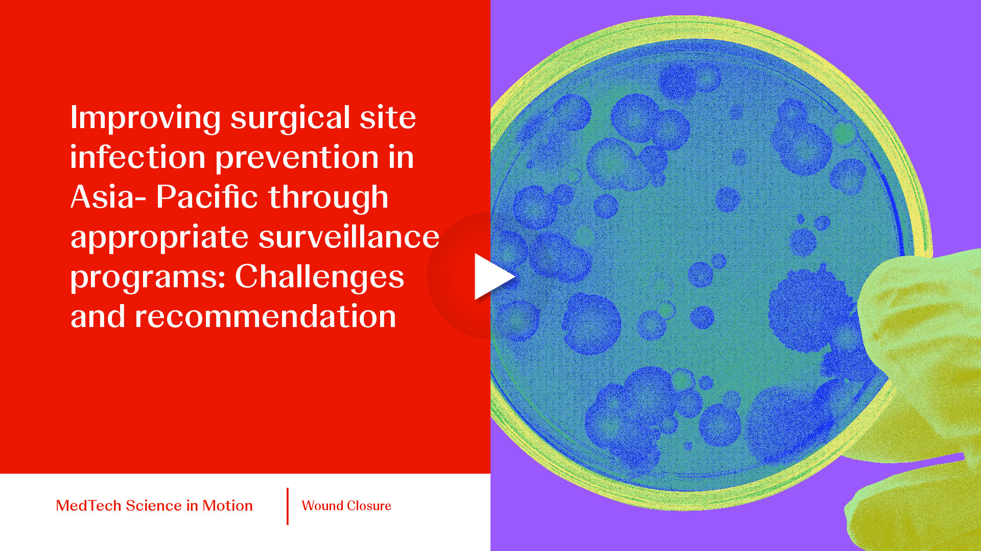 thumb Improving surgical site infection prevention in Asia- Pacific through appropriate surveillance programs Challenges and recommendation