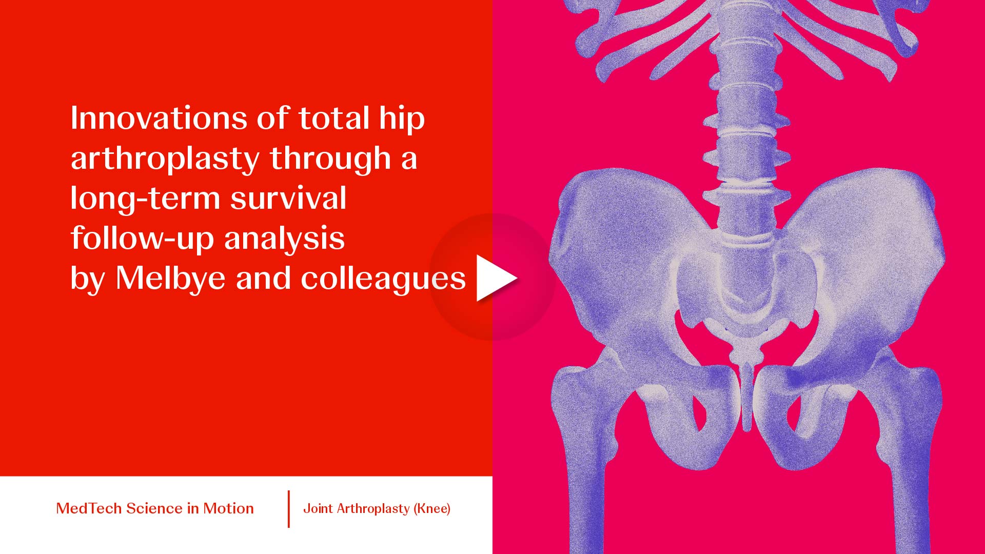 thumb Innovations of total hip arthroplasty-01