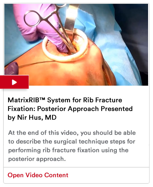 Rib Fixation Program Image