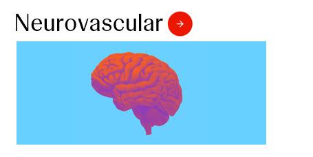 Neurovascular Image