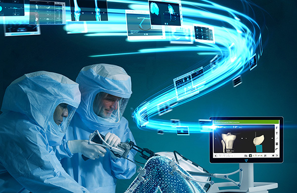 The VELYS™ Robotic-Assisted Solution for Unicompartmental Knee Arthroplasty Image