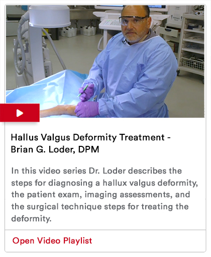 Hallux Valgus Deformity Treatment Image