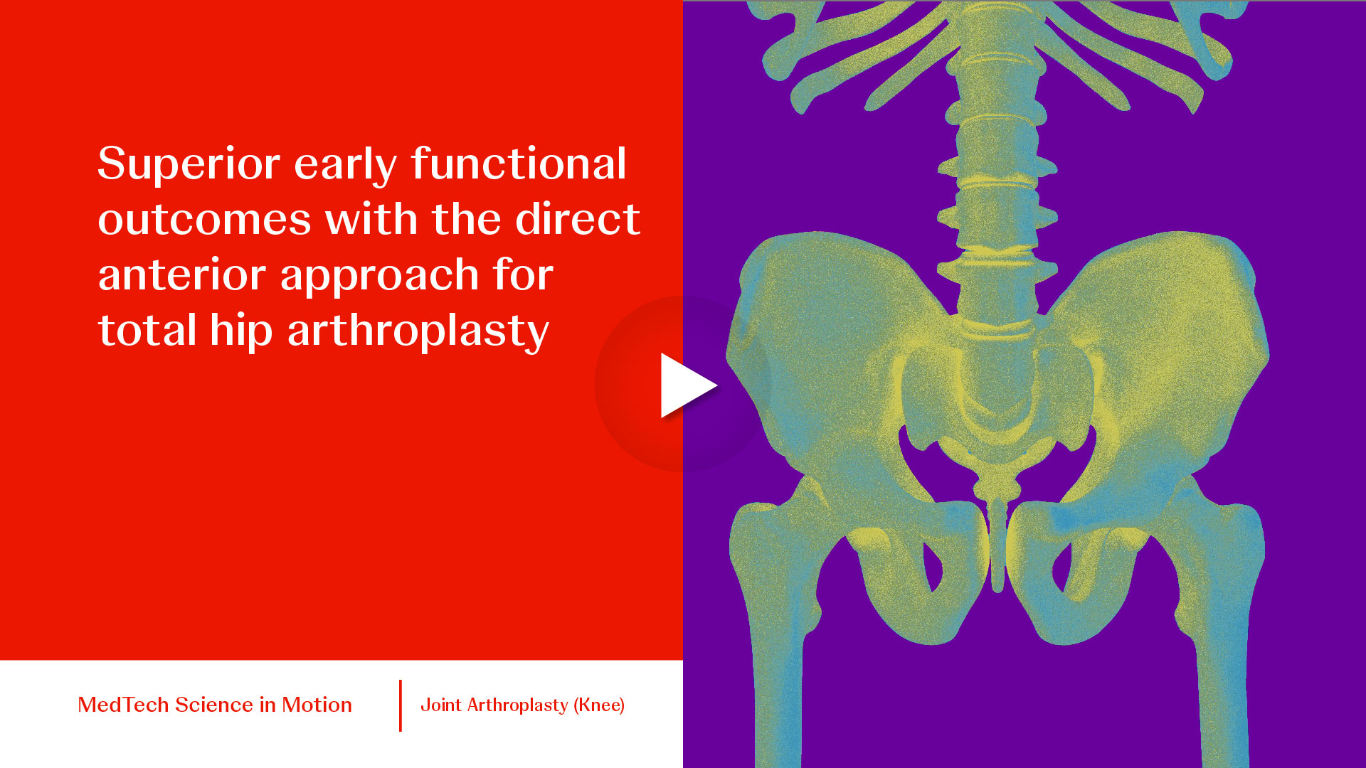 thumb superior early functional outcomes