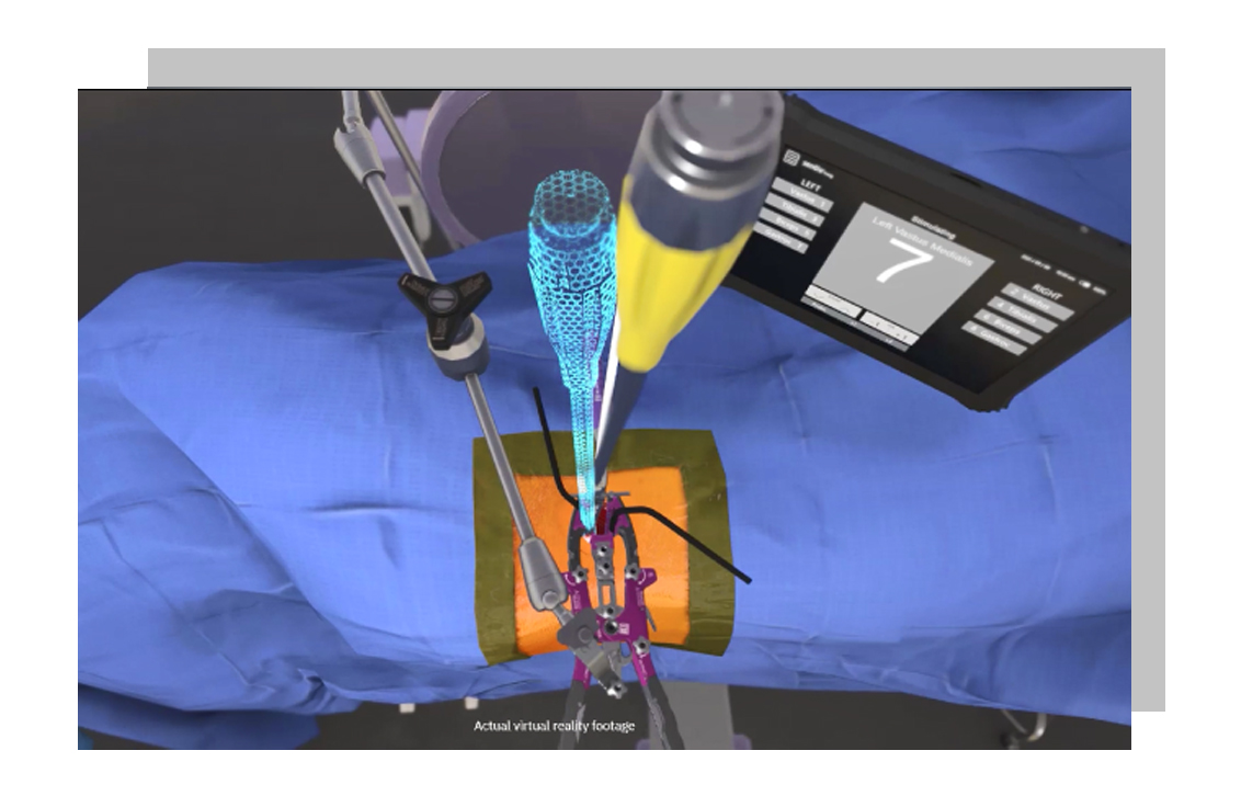 Single Position Lateral Procedure VR Image