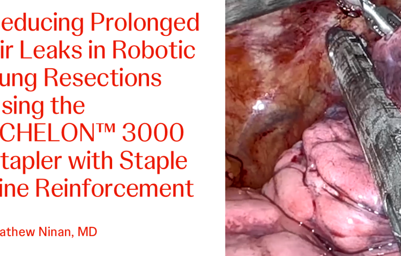 An Image From "Reducing Prolonged Air Leaks in Robotic Lung Resections Using the ECHELON™ 3000 Stapler with Staple Line Reinforcement with Mathew Ninan, MD"