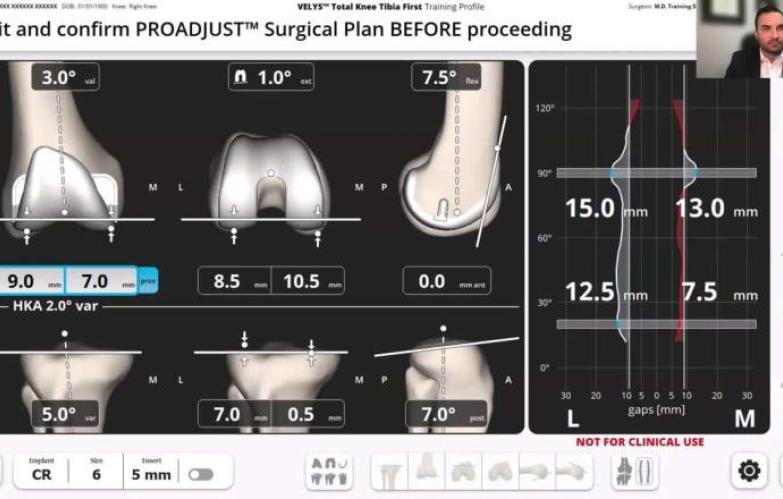 VELYS Robotic-Assisted Solution Case Walkthrough with Dr. John Redmond thumbnail