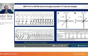 An Image From "Physiologic Basis for Wide Complex Tachycardias including BBVT with Jasbir Sra, MD"