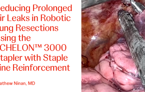 An Image From "Reducing Prolonged Air Leaks in Robotic Lung Resections Using the ECHELON™ 3000 Stapler with Staple Line Reinforcement with Mathew Ninan, MD"