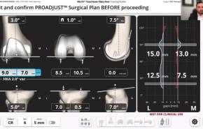 VELYS Robotic-Assisted Solution Case Walkthrough with Dr. John Redmond thumbnail