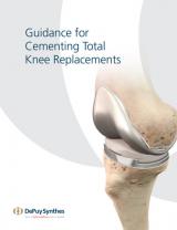 Guidance for Cementing Primary Total Knee Replacements