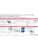 An image from the "Evaluation of Bone-Screw Interface for Lateral Mass Screw Fixation Reinforced with Supplemental Fixation" PDF on the JnJInstitute.com website.