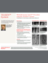 Image from Minimally Invasive VueLIF Procedure using the TELIGEN™ System with Blake Walker, MD