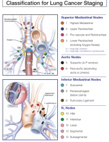 Regional Lymph Node Classification for Lung Cancer Staging