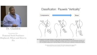 Femoral Neck Fractures: How and When to Fix - Paul Gladden, MD