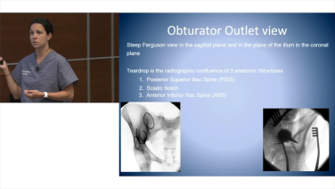 Lumbopelvic Fixation & Iliac Crest Bone Grafting with Lauren Matteini, MD