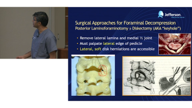 Anterior Cervical Spine Anatomy and Disease States - Srinivas Prasad, MD