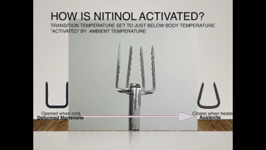 Image from Nitinol Continuous Compression Implants: Clinical Benefits with Kevin Grant, MD