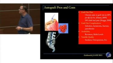 Image from Autograft Pros & Cons - Jamie Lawrence, MD