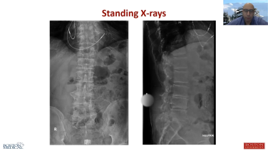 Image from OR Setup & Navigation: Best Practices for Lateral Fusion - Jang Yoon MD