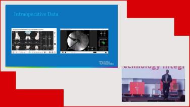 Technology Integration: Outcomes Data with Technology in TKA with Sayfe Jassim, MD thumbnail