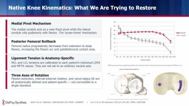 Slide from Knee Morphology and It's Role in the Alignment Shift with Sean Ryan, MD