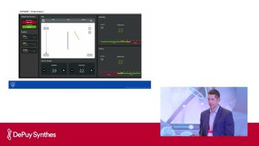 Slide Technology in total hip arthroplasty; AI is the present, Precision is the standard with Cody Wyles, MD
