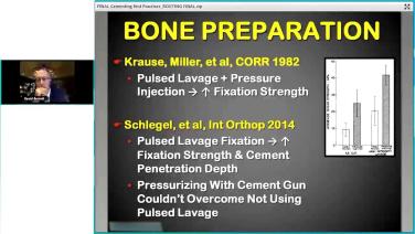 from Best Practices in Cementing Total Knee Arthroplasty with David Barrett, MD