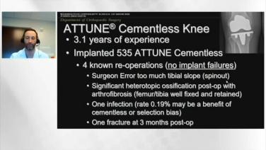 of a slide from Playlist: Techniques and Fixation in TKA with Keith Fehring, MD and Ryan Nunley, MD