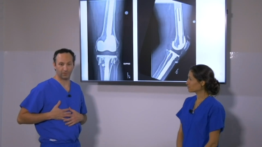 ATTUNE Revision Knee Sytem Procedural Workflow with Ryan Nunley, MD thumbnail