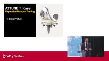 Slide from Boundaries Tested to Fit my TKA Philosophy with Ugo Ihekweazu, MD