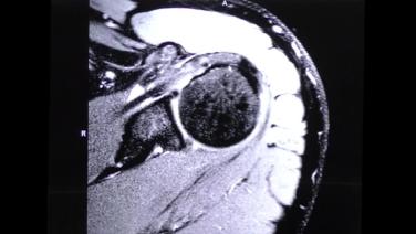 MRI from Standard Approach to reading an MRI; Procedural Walkthrough with Stephanie Muh, MD