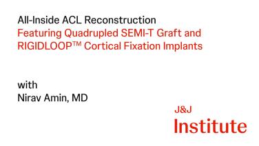 All-Inside ACL Reconstruction using Quadrupled Semi-T Graft and RIGIDLOOP™ Cortical Fixation Implants with Nirav Amin, MD