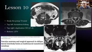 Slide from Understanding Anatomy Pitfalls - Case Studies with Kamal Woods MD