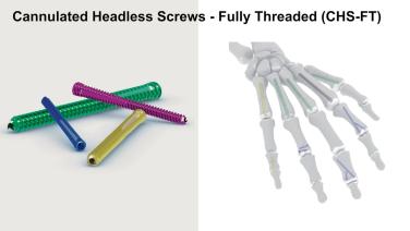 slide from the video series Retrograde Intramedullary Screw Fixation of Metacarpal Fractures Featuring Cannulated Headless Screws - Fully Threaded (CHS-FT) with Kate Woozley, MD