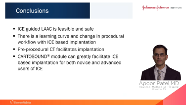 An Image From "Transitioning from TEE to ICE by Integrating the CARTOSOUND® Module for Optimal LAA Visualization with Apoor Patel, MD"