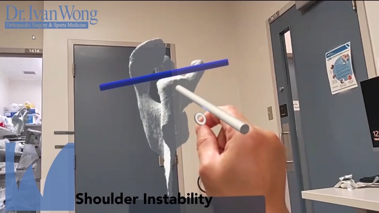 An Image From "AAGR Telementoring Education - Ivan Wong, MD"